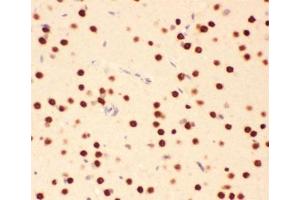 Immunohistochemistry (IHC) image for anti-Activating Transcription Factor 2 (ATF2) (AA 93-450) antibody (ABIN3029845)