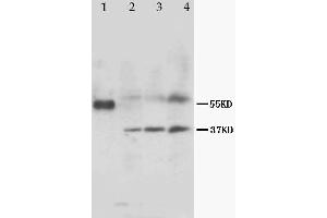 Anti-MRGX1 antibody, Western blotting Lane 1: Marker Lane 2: Rat Heart Tissue Lysate Lane 3: Rat Skeletal Muscle Tissue Lysate Lane 4: MCF-7 Cell Lysate
