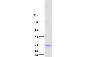 Validation with Western Blot (CYorf15A Protein (Myc-DYKDDDDK Tag))