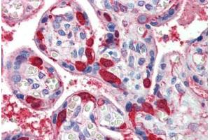 Placenta, Human: Formalin-Fixed, Paraffin-Embedded (FFPE) (LDHB 抗体  (C-Term))
