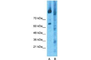Host:  Rabbit  Target Name:  RNF31  Sample Type:  Jurkat Whole Cell  Lane A:  Primary Antibody  Lane B:  Primary Antibody + Blocking Peptide  Primary Antibody Concentration:  1ug/ml  Peptide Concentration:  5ug/ml  Lysate Quantity:  25ug/lane/Lane  Gel Concentration:  0.