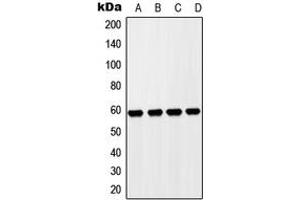 Western blot analysis of ZP4 expression in HepG2 (A), Hela (B), NIH3T3 (C), H9C2 (D) whole cell lysates.