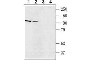 Western blot analysis of rat (lanes 1 and 3) and mouse (lanes 2 and 4) brain lysates: - 1,2. (SLC9A5 抗体  (C-Term, Intracellular))