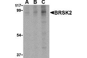 Western Blotting (WB) image for anti-BR serine/threonine Kinase 2 (BRSK2) (C-Term) antibody (ABIN1030303) (BRSK2 抗体  (C-Term))