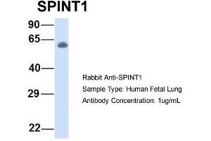Host:  Rabbit  Target Name:  SPINT1  Sample Type:  Human Fetal Lung  Antibody Dilution:  1. (SPINT1 抗体  (Middle Region))
