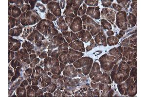 Image no. 5 for anti-DEAD (Asp-Glu-Ala-Asp) Box Polypeptide 58 (DDX58) antibody (ABIN1500708)