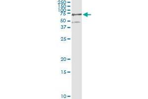 Western Blotting (WB) image for anti-Phosphoglucomutase 3 (PGM3) (AA 1-543) antibody (ABIN598868) (Phosphoglucomutase 3 抗体  (AA 1-543))