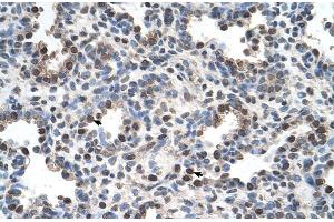 Human Lung (FAM134B 抗体  (Middle Region))