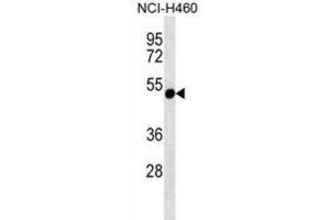Western Blotting (WB) image for anti-Rhabdoid Tumor Deletion Region Gene 1 (RTDR1) antibody (ABIN2997232) (RTDR1 抗体)