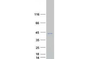 Western Blotting (WB) image for OTU Domain Containing 6B (OTUD6B) protein (Myc-DYKDDDDK Tag) (ABIN2728060)