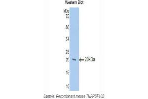Western blot analysis of the recombinant protein. (TNFRSF10B 抗体  (AA 233-367))