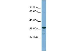 WB Suggested Anti-DHRS9 Antibody Titration: 0. (DHRS9 抗体  (Middle Region))