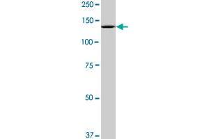SF3B2 monoclonal antibody (M10), clone 2A2. (SF3B2 抗体  (AA 1-636))