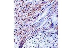 Immunohistochemistry (IHC) image for anti-Tripartite Motif Containing 5 (TRIM5) (Middle Region 2) antibody (ABIN1031206) (TRIM5 抗体  (Middle Region 2))