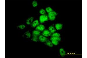 Immunofluorescence (IF) image for anti-serine/threonine Kinase 33 (STK33) (AA 1-514) antibody (ABIN566314)