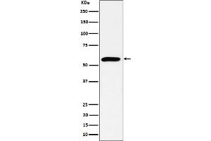 Western blot analysis of PRPF4 expression in HeLa cell lysate.