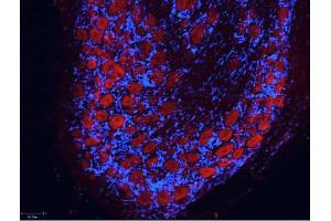 Immunofluorescence (IF) image for Goat anti-Rat IgG (Heavy & Light Chain) antibody (Atto 550) - Preadsorbed (ABIN965003) (山羊 anti-大鼠 IgG (Heavy & Light Chain) Antibody (Atto 550) - Preadsorbed)