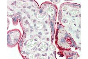 Immunohistochemistry (Paraffin-embedded Sections) (IHC (p)) image for anti-Protein Tyrosine Phosphatase Type IVA, Member 3 (PTP4A3) antibody (ABIN392854)