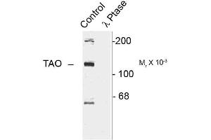 Western blots of rat cortex lysate showing specific immunolabeling of the ~120k TAO2 phosphorylated at Ser181 (Control).