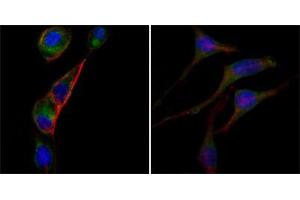 Immunofluorescence analysis of PC-3 (left) and SK-BR-3 (right) cells using anti-GOT2 mAb (green). (GOT2 抗体)