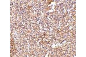 Immunohistochemistry (IHC) image for anti-Six Transmembrane Epithelial Antigen of The Prostate 1 (STEAP1) (Middle Region) antibody (ABIN1031108) (STEAP1 抗体  (Middle Region))