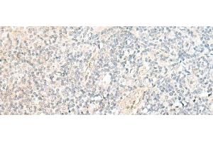 Immunohistochemistry of paraffin-embedded Human tonsil tissue using SNRPD1 Polyclonal Antibody at dilution of 1:70(x200) (SNRPD1 抗体)