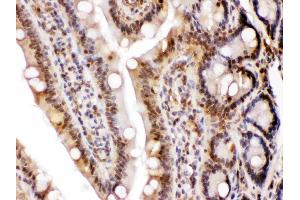 LDHA was detected in paraffin-embedded sections of rat intestine tissues using rabbit anti- LDHA Antigen Affinity purified polyclonal antibody (Catalog # ) at 1 ? (Lactate Dehydrogenase A 抗体  (AA 2-106))