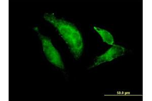 Immunofluorescence of purified MaxPab antibody to TBX20 on HeLa cell. (TBX20 抗体  (AA 1-297))