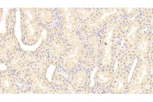 Immunohistochemistry (IHC) image for anti-Interleukin 1 Receptor-Like 1 (IL1RL1) (AA 162-349) antibody (ABIN7437368)