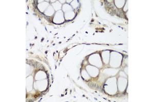 Immunohistochemistry of paraffin-embedded human gastric using WWTR1 antibody (ABIN5974805) at dilution of 1/200 (40x lens). (WWTR1 抗体)