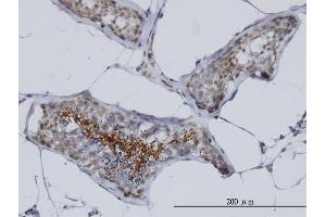 Immunoperoxidase of monoclonal antibody to AKAP4 on formalin-fixed paraffin-embedded human testis. (AKAP4 抗体  (AA 1-100))