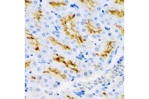 Immunohistochemistry (IHC) image for anti-UDP-Glucose 6-Dehydrogenase (UGDH) antibody (ABIN7308478) (UGDH 抗体)