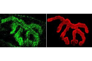 Immunohistochemistry analysis using Rabbit Anti-Piccolo Polyclonal Antibody . (Piccolo 抗体  (Biotin))