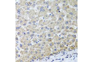 Immunohistochemistry of paraffin-embedded human liver injury using OSGEPL1 antibody at dilution of 1:100 (x40 lens). (OSGEPL1 抗体)