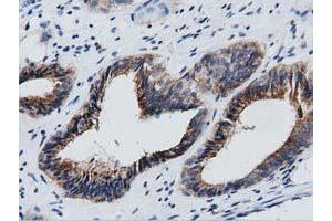 Immunohistochemical staining of paraffin-embedded Human Kidney tissue using anti-GAS7 mouse monoclonal antibody.