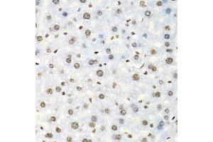 Immunohistochemistry of paraffin-embedded mouse liver using IGF2BP2 antibody (ABIN5971464) at dilution of 1/100 (40x lens). (IGF2BP2 抗体)