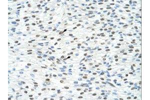 Image no. 1 for anti-Matrin 3 (MATR3) (N-Term) antibody (ABIN203258) (MATR3 抗体  (N-Term))
