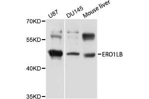 Western blot analysis of extracts of various cell lines, using ERO1LB antibody (ABIN5971901) at 1/1000 dilution. (ERO1LB 抗体)
