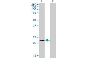 Western Blot analysis of RNF166 expression in transfected 293T cell line by RNF166 MaxPab polyclonal antibody. (RNF166 抗体  (AA 1-237))
