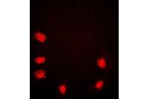 Immunofluorescent analysis of Rpb1 CTD staining in HeLa cells. (Rpb1 CTD 抗体  (C-Term))