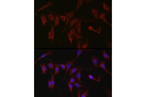 Immunofluorescence analysis of NIH/3T3 cells using PKC zeta Rabbit pAb (ABIN6128468, ABIN6146211, ABIN6146213 and ABIN6221376) at dilution of 1:100 (40x lens). (PKC zeta 抗体  (AA 453-592))