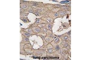 Immunohistochemistry (Paraffin-embedded Sections) (IHC (p)) image for anti-Annexin A2 (ANXA2) (AA 19-49), (N-Term) antibody (ABIN391619)