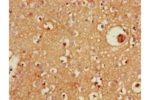 Immunohistochemistry of paraffin-embedded human brain tissue using ABIN7176064 at dilution of 1:100 (ZFYVE26 抗体  (AA 2306-2473))