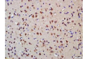 Formalin-fixed and paraffin embedded rat brain labeled with Anti-Melanoregulin Polyclonal Antibody, Unconjugated  at 1:200 followed by conjugation to the secondary antibody and DAB staining (MREG 抗体  (AA 120-160))