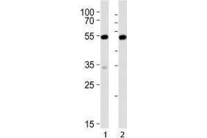Western blot analysis of lysate from 1) mouse NIH3T3 and 2) rat C6 cell line using Srf antibody at 1:1000. (SRF 抗体  (C-Term))
