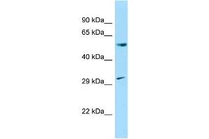 WB Suggested Anti-Ccnl1 Antibody Titration: 1. (Cyclin L1 抗体  (N-Term))