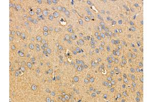 ABIN6255025 and ABIN6266462 at 1/100 staining Rat brain tissue by IHC-P. (RIPK2 抗体  (pSer176))