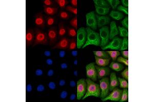 ABIN6257252 and ABIN6273611 staining Hela cells by IF/ICC. (HSPB8 抗体  (C-Term))