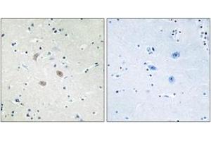 Immunohistochemistry analysis of paraffin-embedded human brain tissue, using Akt2 (Ab-474) Antibody. (AKT2 抗体  (AA 432-481))