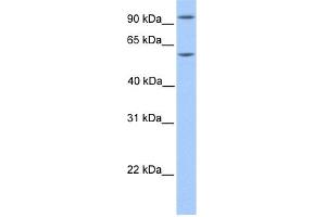 WB Suggested Anti-NFATC4 Antibody Titration:  0. (NFATC4 抗体  (N-Term))